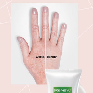 Avon Renew Clinical Creme Clareador Para Mãos Corretor de Imperfeições FPS 15 75g
